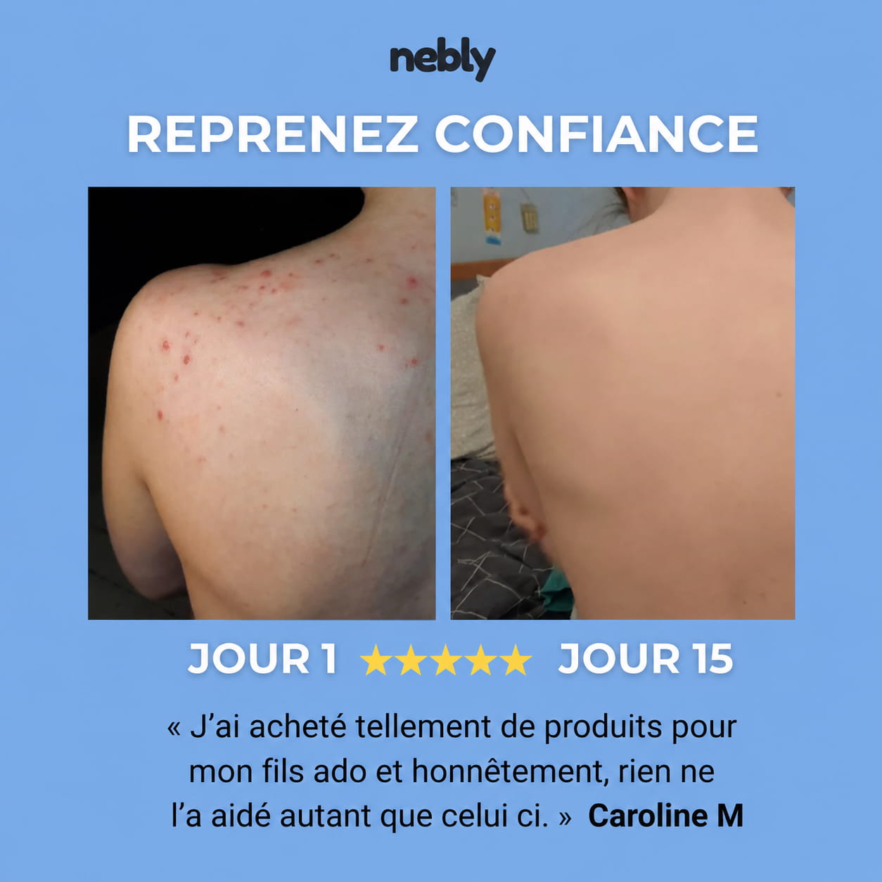 Savon dos net nebly