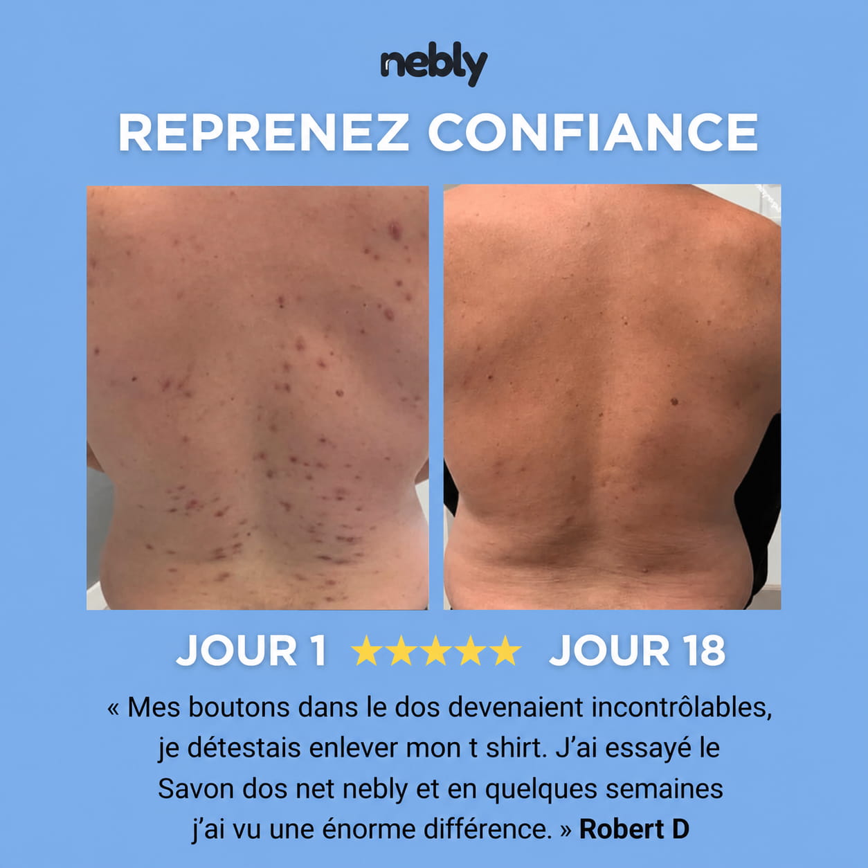 Savon dos net nebly
